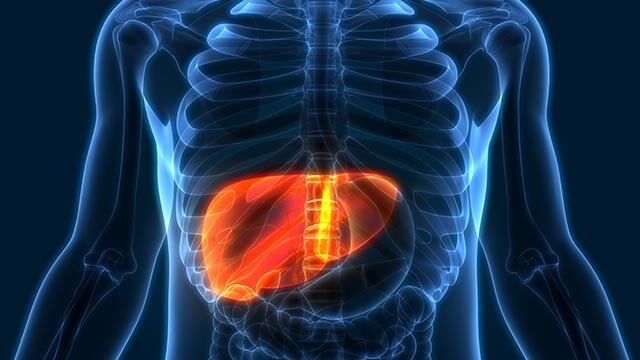 Naturally Reduce Symptoms of Fatty Liver Disease