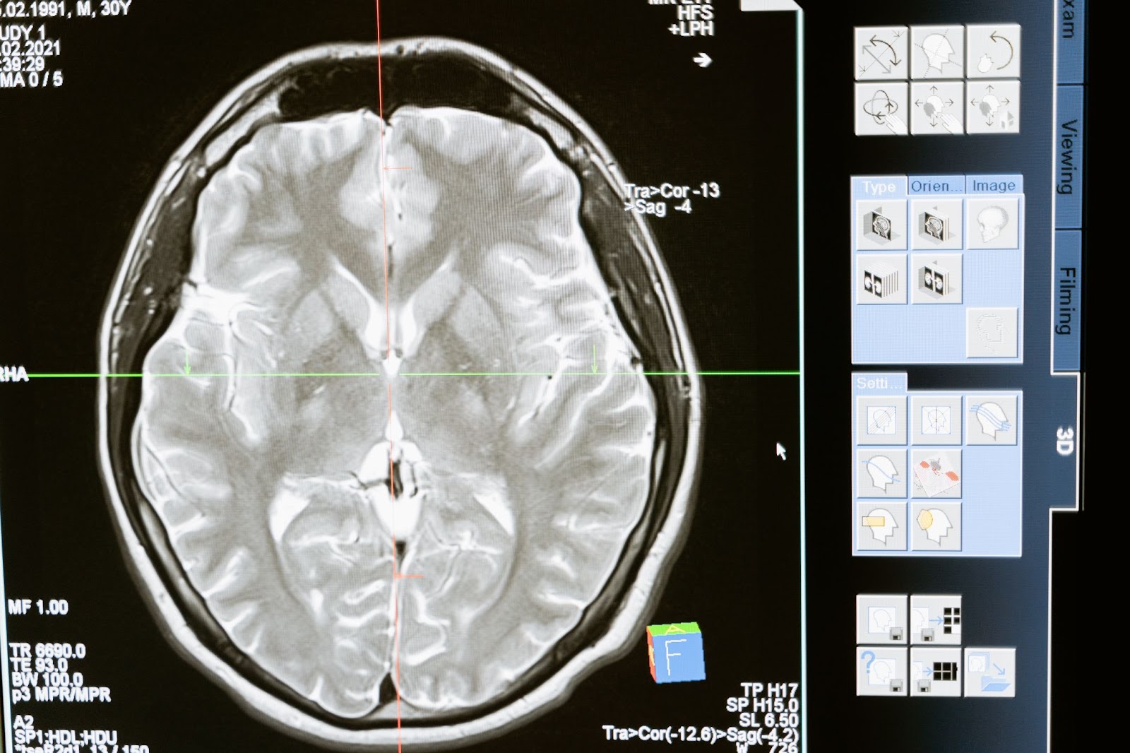 An X-ray scan of the human brain