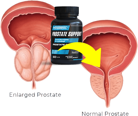 PrimeGENIX Prostate Complex