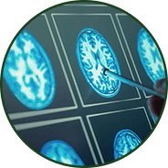 Brain Health - GenuinePurity® CoQ10