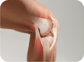 GenuinePurity Liposomal HLA