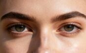 Under-Eye Aging: Solutions for Dark Circles and Fine Lines 